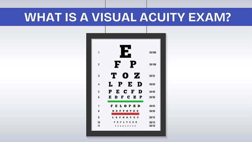 Understanding 20/200 Vision: What It Means and How Eyewear Can Help