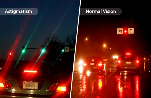 Astigmatism