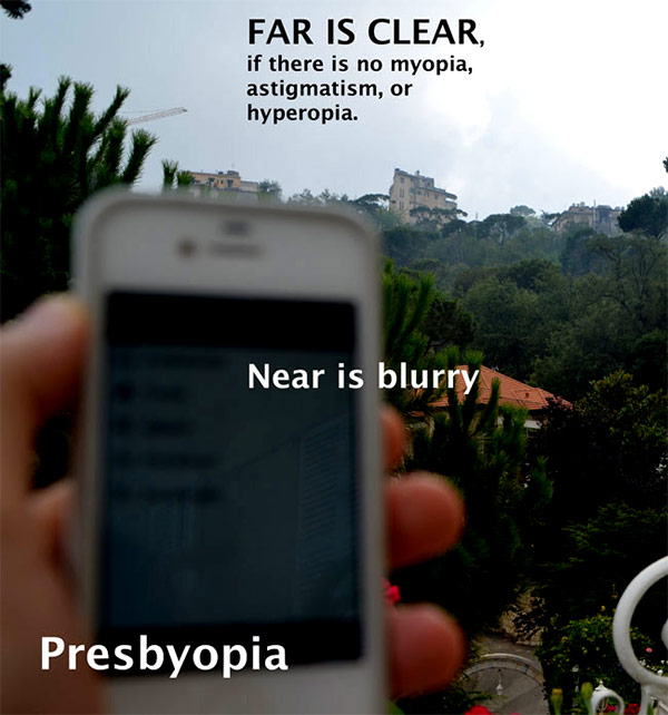 Presbyopia
